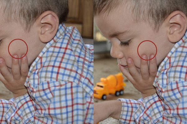Using the Spot Healing Brush